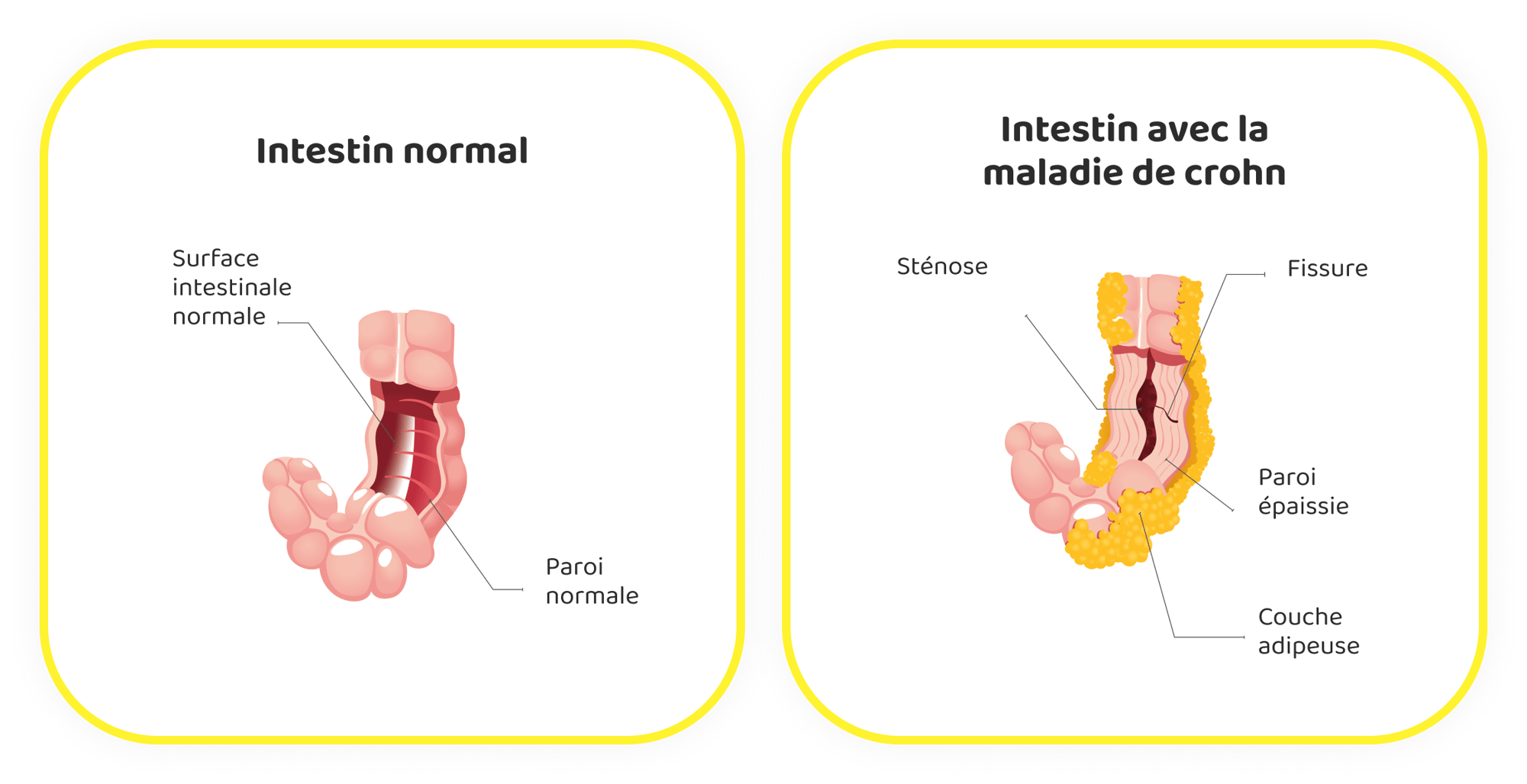 Intestin FR