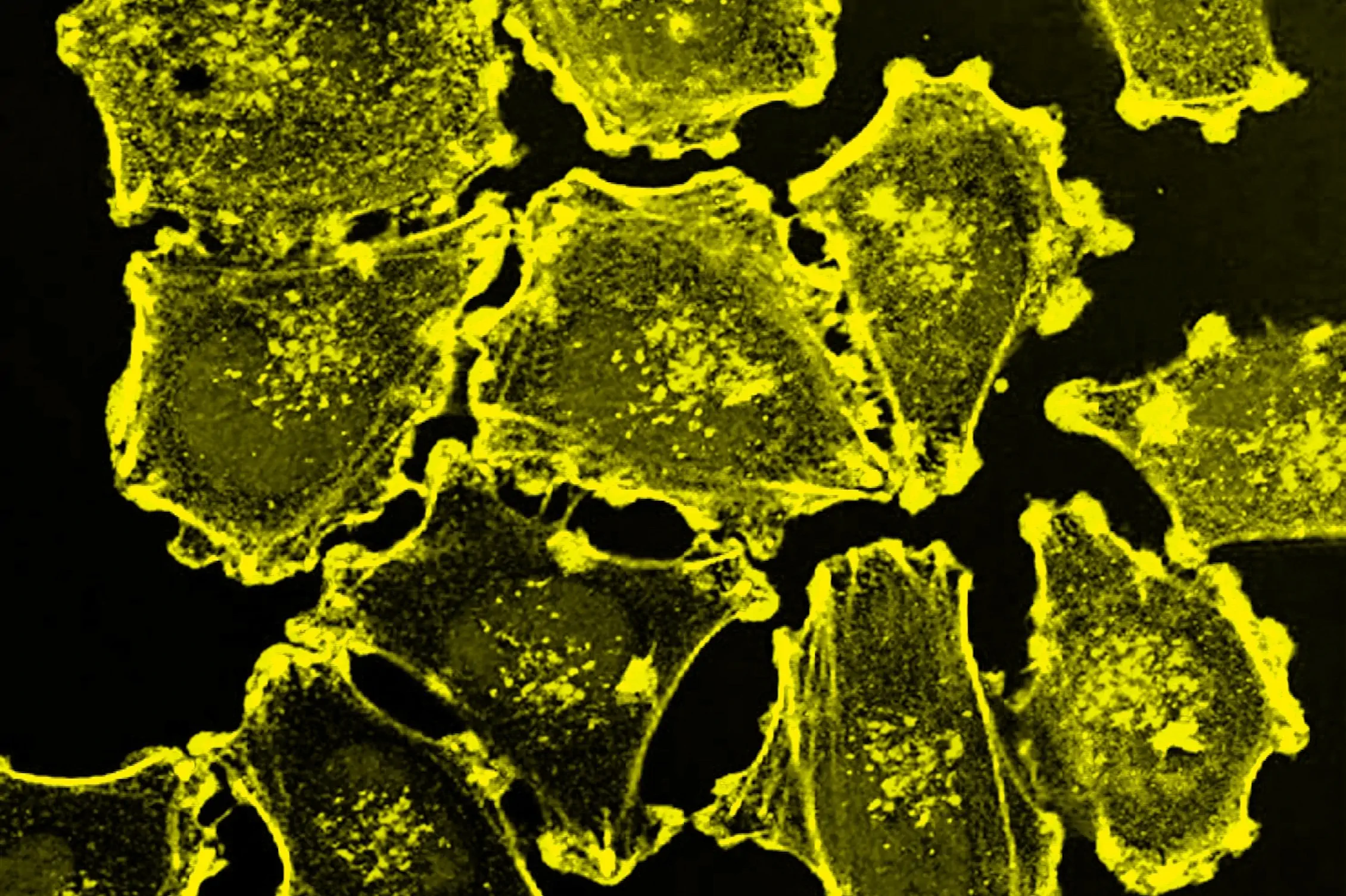 molecule-closeup-6 yellow landscape 3x2