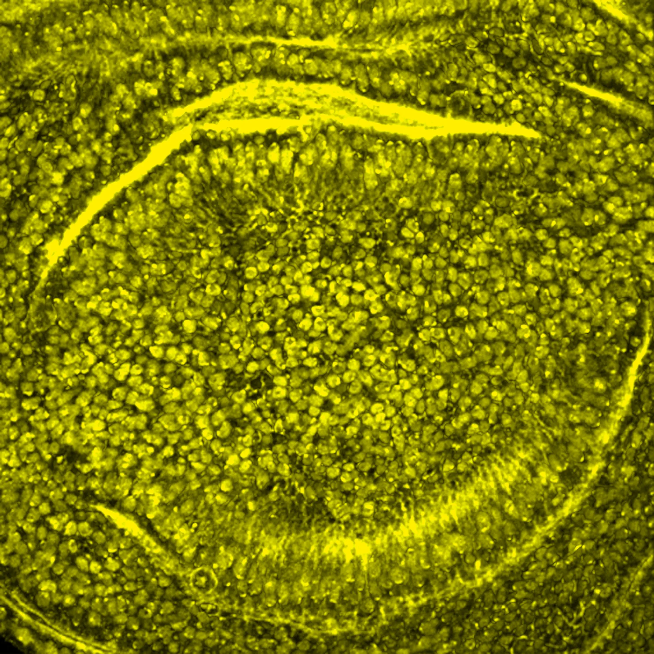 molecule-closeup-3 yellow