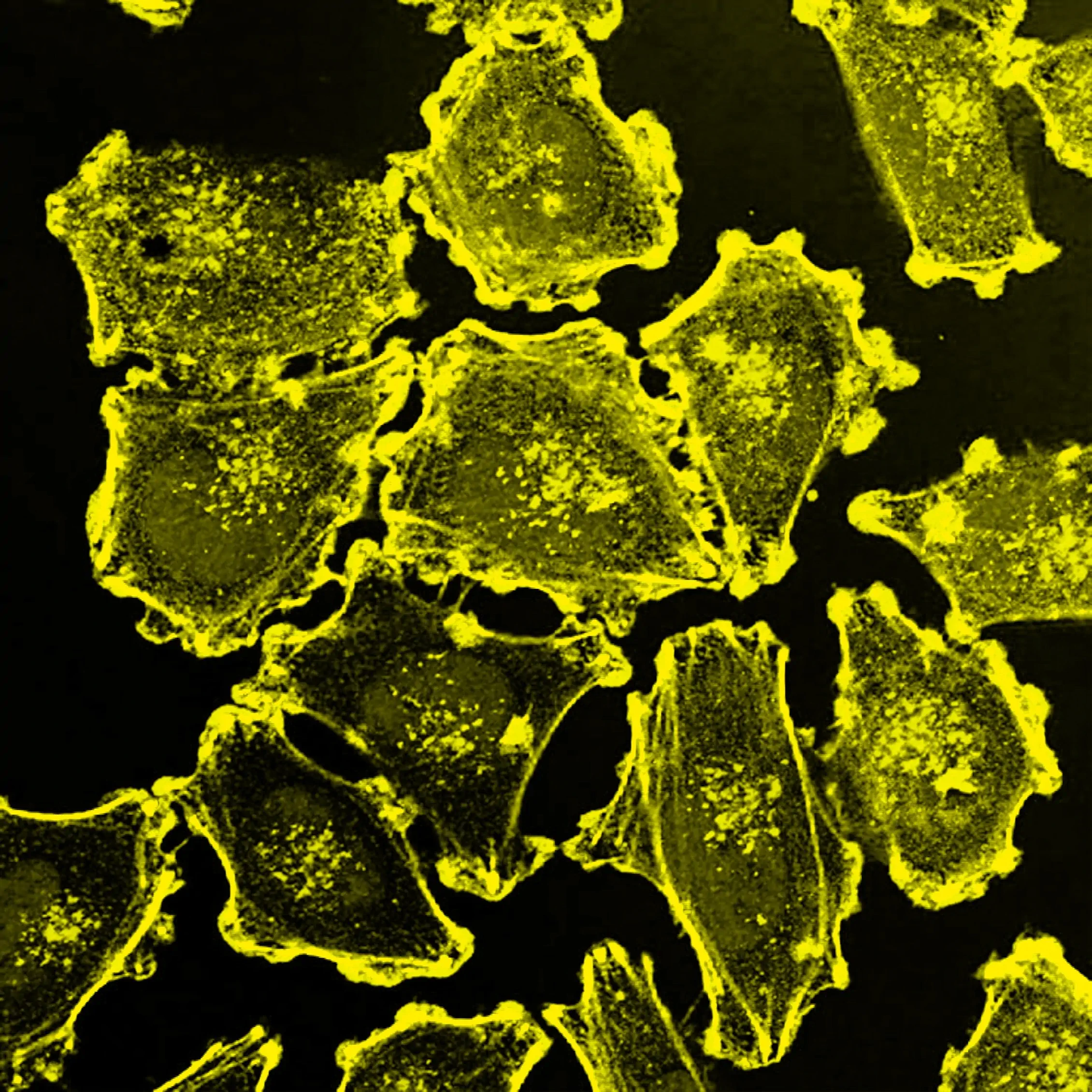molecule-closeup-6 yellow square